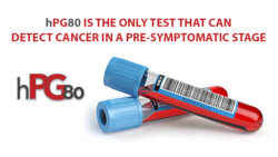 Cancer Detection hPG80 Blood Test