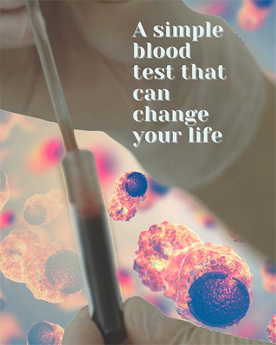 hPG80 Cancer Detection